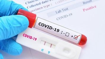 Danh sách các loại test nhanh được Bộ Y tế cấp phép